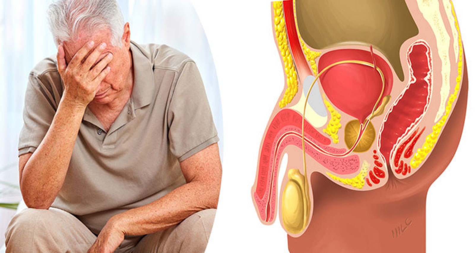 روش های تشخیص سرطان پروستات