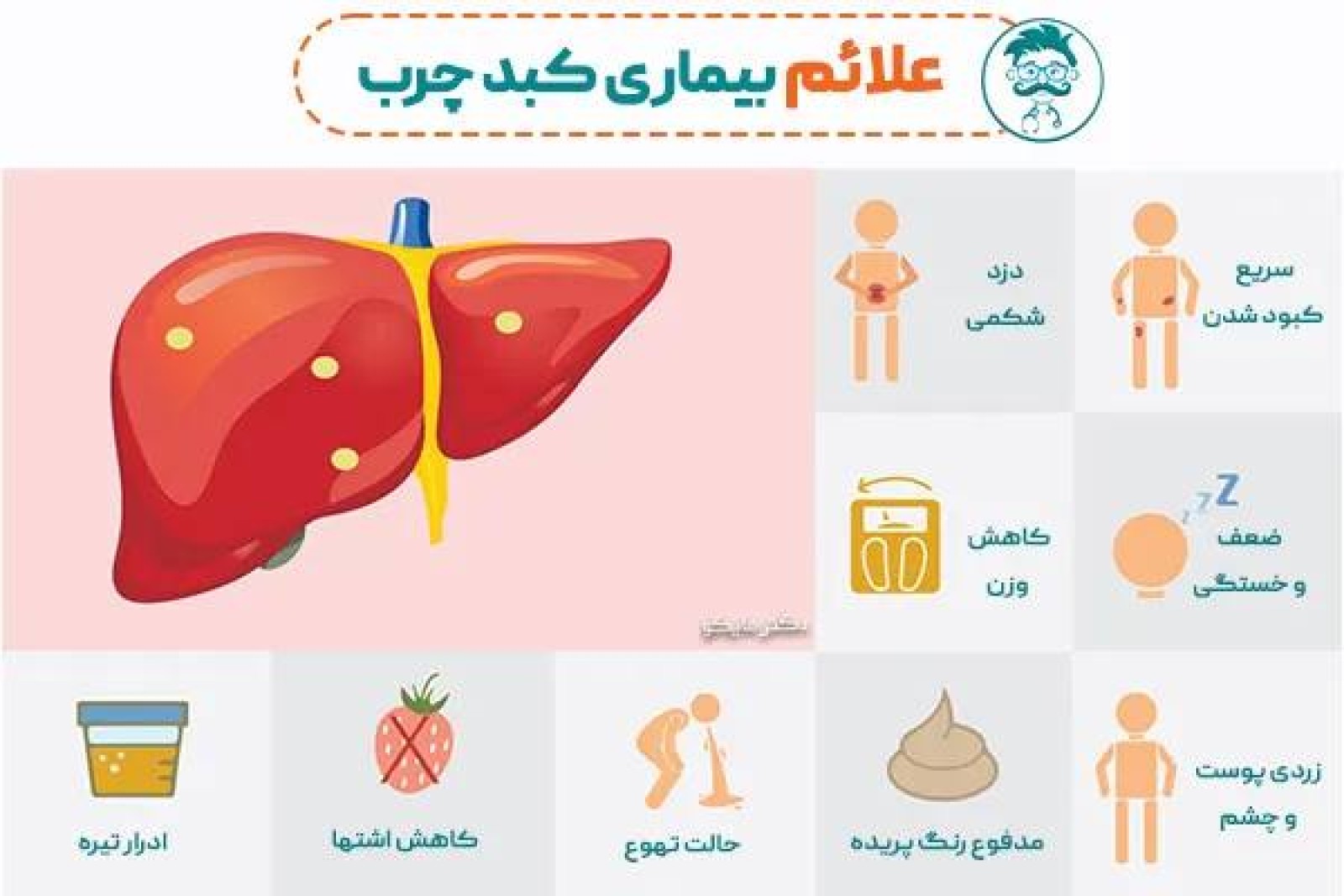 علائم کبد چرب
