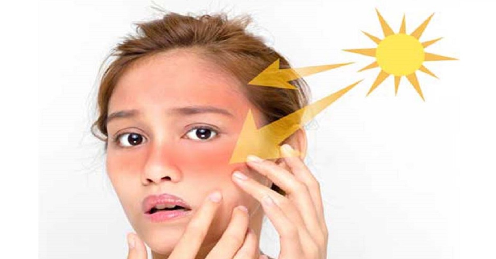 نکات مهم برنزه شدن یا آفتاب